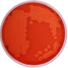 Pic 1. E. coli plate water testing kit Pic 1. E. coli plate water testing kit